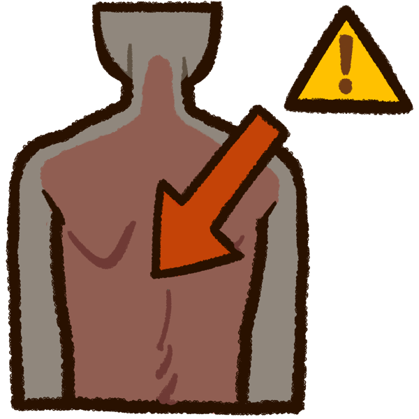 View from behind of a humanoid with grayish skin tone. The spinal area including the neck has been colored red. An overlayed arrow points to the midcenter of the backbone / spinal cord.  Adjacent to the arrow's base is a yellow triangle with an exclamation point inside.